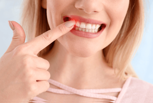 Periodontal Disease Treatment in Salina, KS